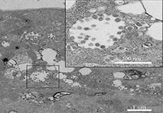 基于高等级生物安全实验室的新冠肺炎基础及其转化研究